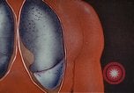 Standbild Penicillin United States USA, 1950, aus Sekunde 31 historischem Filmmaterial Videoclip 65675024762