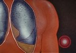 Standbild Penicillin United States USA, 1950, aus Sekunde 32 historischem Filmmaterial Videoclip 65675024762