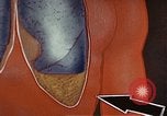 Standbild Penicillin United States USA, 1950, aus Sekunde 37 historischem Filmmaterial Videoclip 65675024762