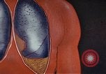 Standbild Penicillin United States USA, 1950, aus Sekunde 56 historischem Filmmaterial Videoclip 65675024762
