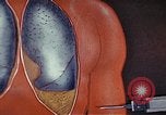 Standbild Penicillin United States USA, 1950, aus Sekunde 59 historischem Filmmaterial Videoclip 65675024762