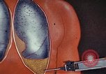 Standbild Penicillin United States USA, 1950, aus Sekunde 60 historischem Filmmaterial Videoclip 65675024762
