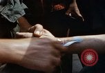 Immagine di I civili trattate sotto di noi medici azione civica programma (MEDCAP) Il Vietnam, 1967, secondo 33 filmato di repertorio 65675025981