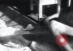 Image of Tuberculosis of bone Vienna Austria, 1923, second 8 stock footage video 65675027116