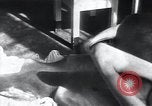 Image of Tuberculosis of bone Vienna Austria, 1923, second 9 stock footage video 65675027116