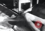 Image of Tuberculosis of bone Vienna Austria, 1923, second 10 stock footage video 65675027116