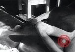 Image of Tuberculosis of bone Vienna Austria, 1923, second 11 stock footage video 65675027116
