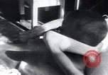 Image of Tuberculosis of bone Vienna Austria, 1923, second 12 stock footage video 65675027116