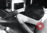Image of Tuberculosis of bone Vienna Austria, 1923, second 13 stock footage video 65675027116