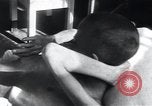 Image of Tuberculosis of bone Vienna Austria, 1923, second 14 stock footage video 65675027116