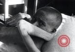 Image of Tuberculosis of bone Vienna Austria, 1923, second 18 stock footage video 65675027116