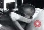 Image of Tuberculosis of bone Vienna Austria, 1923, second 19 stock footage video 65675027116