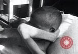 Image of Tuberculosis of bone Vienna Austria, 1923, second 20 stock footage video 65675027116