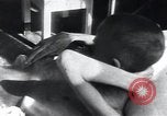 Image of Tuberculosis of bone Vienna Austria, 1923, second 23 stock footage video 65675027116
