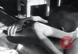 Image of Tuberculosis of bone Vienna Austria, 1923, second 25 stock footage video 65675027116