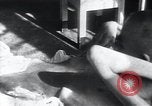 Image of Tuberculosis of bone Vienna Austria, 1923, second 28 stock footage video 65675027116