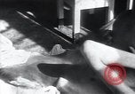 Image of Tuberculosis of bone Vienna Austria, 1923, second 29 stock footage video 65675027116