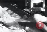 Image of Tuberculosis of bone Vienna Austria, 1923, second 31 stock footage video 65675027116