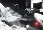Image of Tuberculosis of bone Vienna Austria, 1923, second 32 stock footage video 65675027116