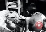 Image of Tuberculosis of bone Vienna Austria, 1923, second 40 stock footage video 65675027116