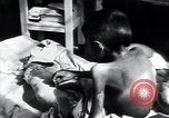Image of Tuberculosis of bone Vienna Austria, 1923, second 41 stock footage video 65675027116