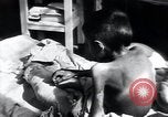 Image of Tuberculosis of bone Vienna Austria, 1923, second 42 stock footage video 65675027116