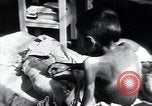 Image of Tuberculosis of bone Vienna Austria, 1923, second 43 stock footage video 65675027116
