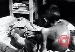 Image of Tuberculosis of bone Vienna Austria, 1923, second 44 stock footage video 65675027116