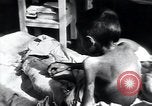 Image of Tuberculosis of bone Vienna Austria, 1923, second 46 stock footage video 65675027116