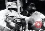 Image of Tuberculosis of bone Vienna Austria, 1923, second 47 stock footage video 65675027116