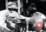 Image of Tuberculosis of bone Vienna Austria, 1923, second 48 stock footage video 65675027116