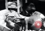 Image of Tuberculosis of bone Vienna Austria, 1923, second 49 stock footage video 65675027116
