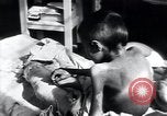 Image of Tuberculosis of bone Vienna Austria, 1923, second 54 stock footage video 65675027116