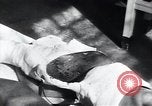 Image of Tuberculosis of skin Vienna Austria, 1923, second 8 stock footage video 65675027117