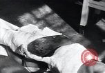 Image of Tuberculosis of skin Vienna Austria, 1923, second 9 stock footage video 65675027117