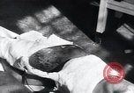 Image of Tuberculosis of skin Vienna Austria, 1923, second 10 stock footage video 65675027117
