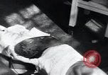 Image of Tuberculosis of skin Vienna Austria, 1923, second 11 stock footage video 65675027117