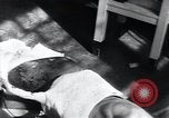 Image of Tuberculosis of skin Vienna Austria, 1923, second 12 stock footage video 65675027117