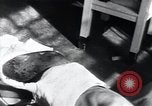 Image of Tuberculosis of skin Vienna Austria, 1923, second 13 stock footage video 65675027117