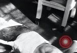 Image of Tuberculosis of skin Vienna Austria, 1923, second 14 stock footage video 65675027117