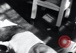 Image of Tuberculosis of skin Vienna Austria, 1923, second 15 stock footage video 65675027117
