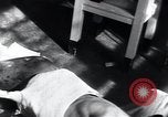Image of Tuberculosis of skin Vienna Austria, 1923, second 16 stock footage video 65675027117