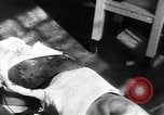 Image of Tuberculosis of skin Vienna Austria, 1923, second 19 stock footage video 65675027117