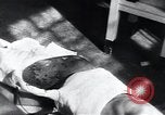 Image of Tuberculosis of skin Vienna Austria, 1923, second 20 stock footage video 65675027117