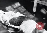 Image of Tuberculosis of skin Vienna Austria, 1923, second 21 stock footage video 65675027117