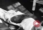 Image of Tuberculosis of skin Vienna Austria, 1923, second 22 stock footage video 65675027117