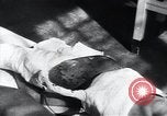 Image of Tuberculosis of skin Vienna Austria, 1923, second 23 stock footage video 65675027117