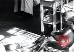Image of Tuberculosis of bone and skin Vienna Austria, 1923, second 11 stock footage video 65675027118