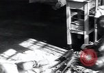Image of Tuberculosis of bone and skin Vienna Austria, 1923, second 13 stock footage video 65675027118