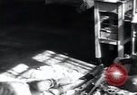 Image of Tuberculosis of bone and skin Vienna Austria, 1923, second 14 stock footage video 65675027118